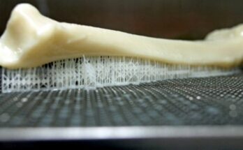 Учёные ЮФУ разработали основу для «умных» имплантатов, превращающихся в живую костную ткань